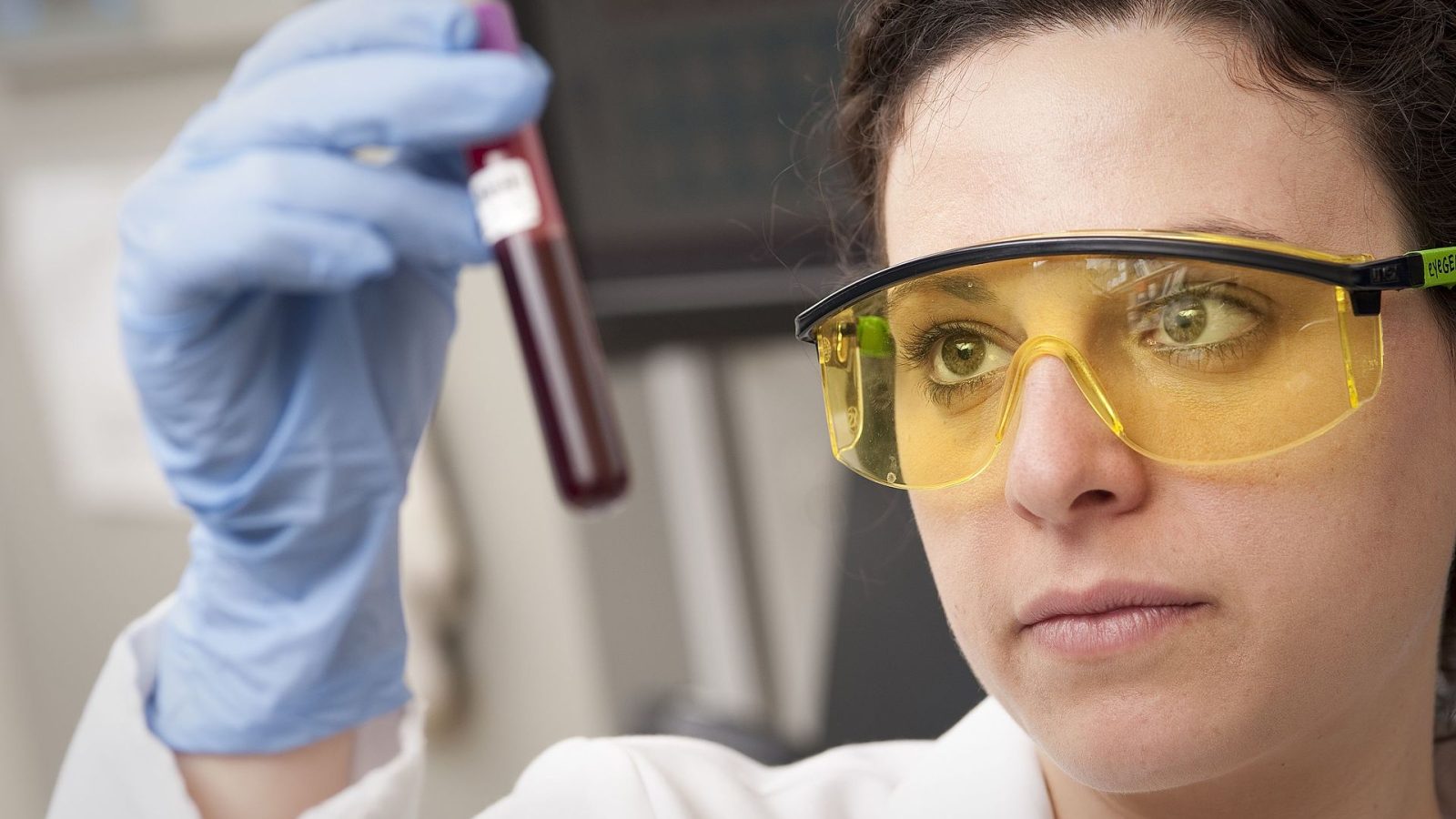 Amostra de sangue em laboratório