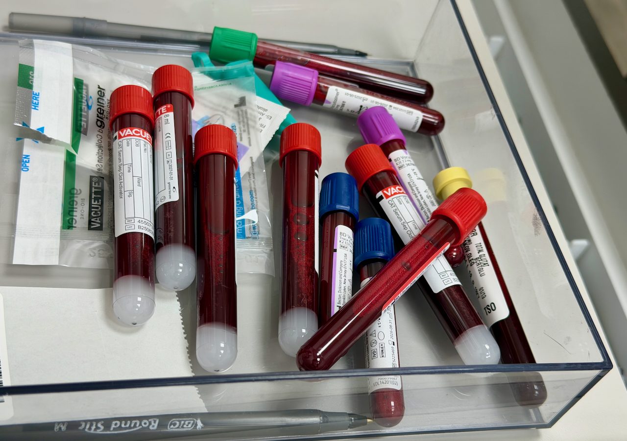 Julho Amarelo: unidades de saúde de Cuiabá reforçam testagem contra hepatites virais
