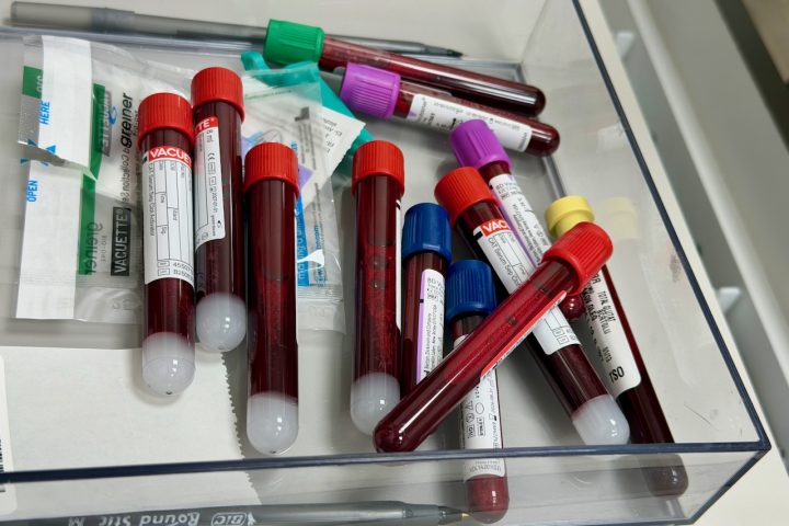 Julho Amarelo: unidades de saúde de Cuiabá reforçam testagem contra hepatites virais