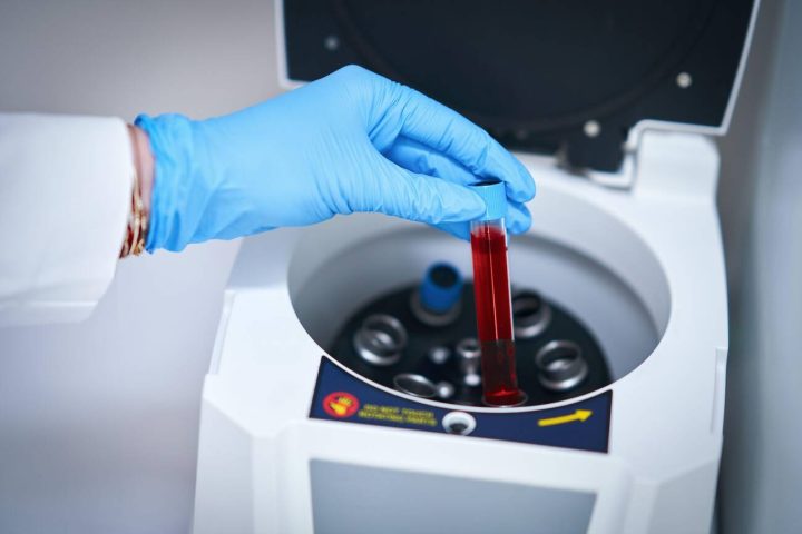 Mão com luva azul coloca tubo de amostra de sangue em centrífuga de laboratório de análises clínicas